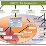 Depression and Obesity Complications are Inextricably Linked. Discover the Most Powerful Exercises to Fight Depression and Obesity Today.