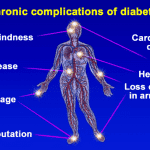 can-type-2-diabetes-be-reversed